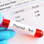 Signs that it’s time to get a comprehensive thyroid function test