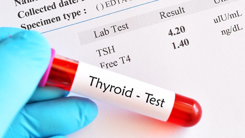 thyroid function test